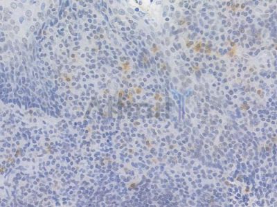 Brm Recombinant Rabbit mAb - BF4023 at 1/100 staining Human tonsil tissue by IHC-P.
