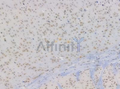 Brm Recombinant Rabbit mAb - BF4023 at 1/100 staining Mouse brain tissue by IHC-P.