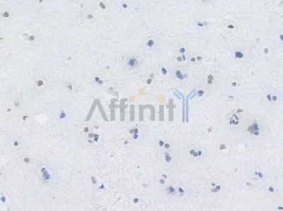 Brm Recombinant Rabbit mAb - BF4023 at 1/100 staining Human brain tissue by IHC-P.