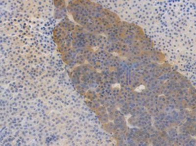 BNIP3 Recombinant Rabbit mAb - BF4025 at 1/100 staining Mouse renal tissue by IHC-P.
