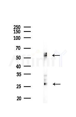 BNIP3 Recombinant Rabbit mAb - Western blot analysis of lysates from Mouse muscle, using BNIP3 Recombinant Rabbit mAb at 1/1000 dilution.