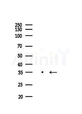 Caspase 3 Recombinant Rabbit mAb - Western blot analysis of lysates from Mouse muscle, using Caspase 3 Recombinant Rabbit mAb at 1/1000 dilution.