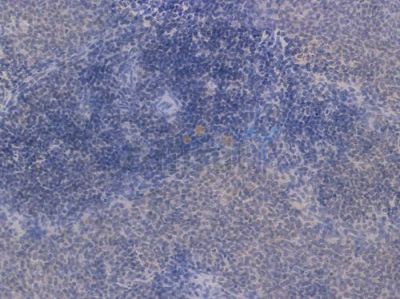 Bcl-2 Recombinant Rabbit mAb - BF4027 at 1/100 staining Rat spleen tissue by IHC-P.