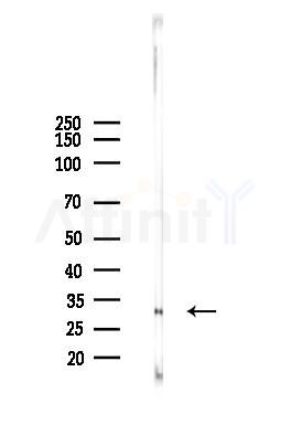 Bcl-2 Recombinant Rabbit mAb - Western blot analysis of lysates from Rat brain, using Bcl-2 Recombinant Rabbit mAb at 1/1000 dilution.