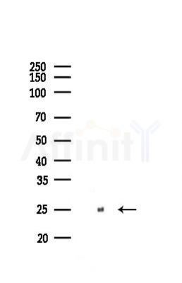 Bcl-2 Recombinant Rabbit mAb - Western blot analysis of lysates from Mouse lung, using Bcl-2 Recombinant Rabbit mAb at 1/1000 dilution.