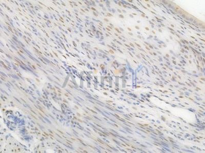 c-Jun Recombinant Rabbit mAb - BF4030 at 1/100 staining Rat uterine tissue by IHC-P.