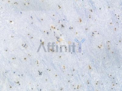 RBBP4 Recombinant Rabbit mAb - BF4032 at 1/100 staining Human brain tissue by IHC-P.