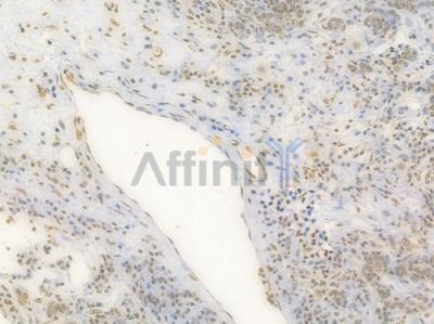 HMGB1 Recombinant Rabbit mAb - BF4033 at 1/100 staining Human gastric tissue by IHC-P.