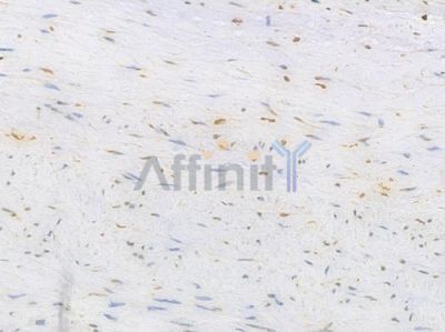 HMGB1 Recombinant Rabbit mAb - BF4033 at 1/100 staining Human aortic tissue by IHC-P.
