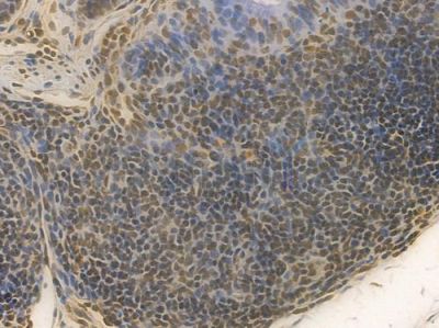HMGB1 Recombinant Rabbit mAb - BF4033 at 1/100 staining Mouse rectal tissue by IHC-P.