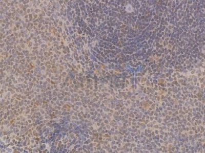 HMGB1 Recombinant Rabbit mAb - BF4033 at 1/100 staining Rat spleen tissue by IHC-P.