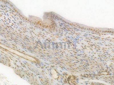 HMGB1 Recombinant Rabbit mAb - BF4033 at 1/100 staining Rat uterine tissue by IHC-P.