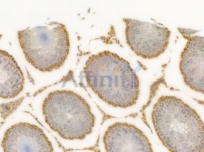 HMGB1 Recombinant Rabbit mAb - BF4033 at 1/100 staining Rat testicular tissue by IHC-P.