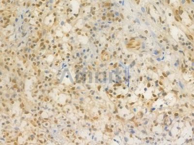 HMGB1 Recombinant Rabbit mAb - BF4033 at 1/100 staining Human spleen tissue by IHC-P.