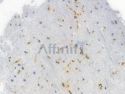 HMGB1 Recombinant Rabbit mAb - BF4033 at 1/100 staining Human brain tissue by IHC-P.