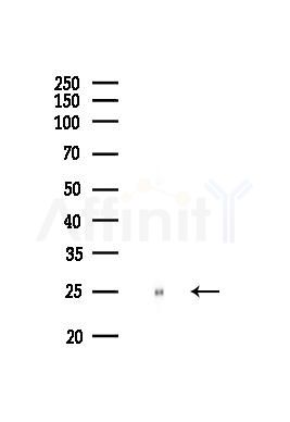 HMGB1 Recombinant Rabbit mAb - Western blot analysis of lysates from Mouse kidney, using HMGB1 Recombinant Rabbit mAb at 1/1000 dilution.