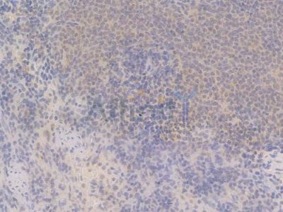 UBB Recombinant Rabbit mAb - BF4034 at 1/100 staining Rat spleen tissue by IHC-P.