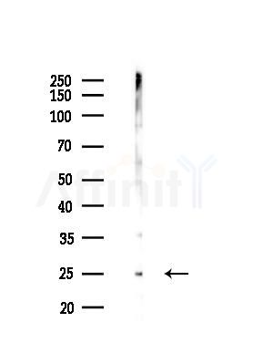 UBB Recombinant Rabbit mAb - Western blot analysis of lysates from Hela cells(LPS 4h treatment), using UBB Recombinant Rabbit mAb at 1/1000 dilution.