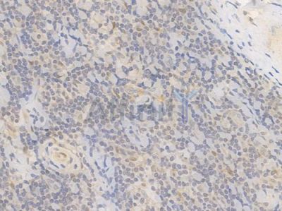 Hsp70 Recombinant Rabbit mAb - BF4035 at 1/100 staining Human tonsil tissue by IHC-P.