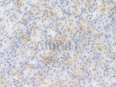 Phospho-GSK3 beta (Ser9) Recombinant Rabbit mAb - BF4036 at 1/100 staining Human spleen tissue by IHC-P.