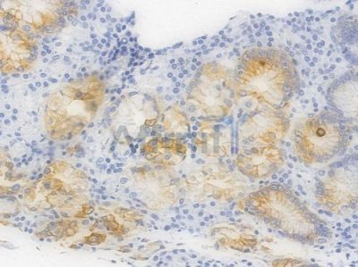 Phospho-GSK3 beta (Ser9) Recombinant Rabbit mAb - BF4036 at 1/100 staining Human gastric tissue by IHC-P.