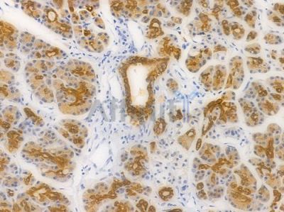 Phospho-GSK3 beta (Ser9) Recombinant Rabbit mAb - BF4036 at 1/100 staining Human pancreatic tissue by IHC-P.