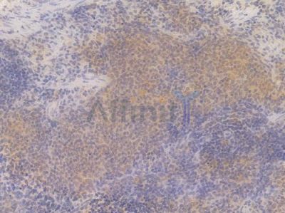 STAT3 Recombinant Rabbit mAb - BF4037 at 1/100 staining Rat spleen tissue by IHC-P.