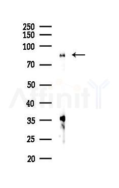 STAT3 Recombinant Rabbit mAb - Western blot analysis of lysates from HUVEC cells(starvation 24h treatment), using STAT3 Recombinant Rabbit mAb at 1/1000 dilution.