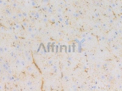 GFAP Recombinant Rabbit mAb - BF4038 at 1/100 staining Rat brain tissue by IHC-P.