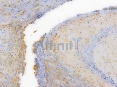 GFAP Recombinant Rabbit mAb - BF4038 at 1/100 staining Mouse brain tissue by IHC-P.