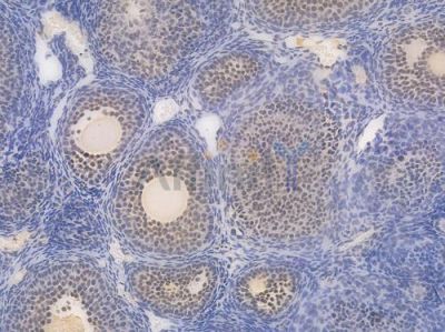 Ki67 Recombinant Rabbit mAb - BF4039 at 1/100 staining Mouse ovarian tissue by IHC-P.