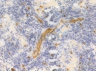HIF1A Recombinant Rabbit mAb - BF4040 at 1/100 staining Human lymph node tissue by IHC-P.