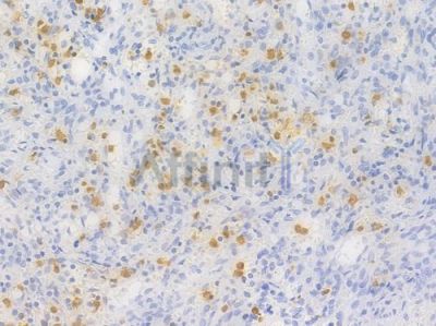 HIF1A Recombinant Rabbit mAb - BF4040 at 1/100 staining Human spleen tissue by IHC-P.
