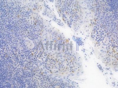 p21 Cip1 Recombinant Rabbit mAb - BF4041 at 1/100 staining Human tonsil tissue by IHC-P.