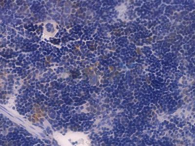 p21 Cip1 Recombinant Rabbit mAb - BF4041 at 1/100 staining Mouse spleen tissue by IHC-P.