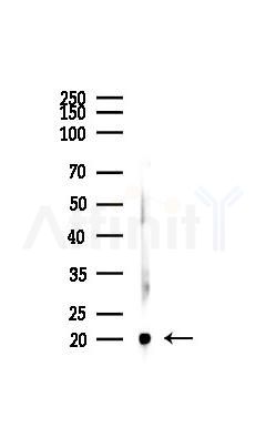 p21 Cip1 Recombinant Rabbit mAb - Western blot analysis of lysates from Mouse kidney, using p21 Cip1 Recombinant Rabbit mAb at 1/1000 dilution.