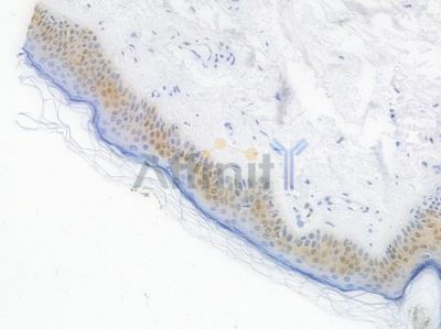 Cyclin D1 Recombinant Rabbit mAb - BF4042 at 1/100 staining Human skin tissue by IHC-P.