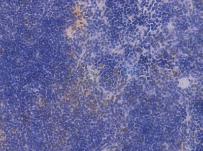 Cyclin D1 Recombinant Rabbit mAb - BF4042 at 1/100 staining Mouse spleen tissue by IHC-P.