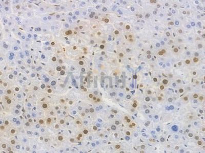 Cyclin D1 Recombinant Rabbit mAb - BF4042 at 1/100 staining Mouse liver tissue by IHC-P.