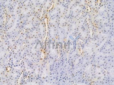 Cyclin D1 Recombinant Rabbit mAb - BF4042 at 1/100 staining Rat renal tissue by IHC-P.