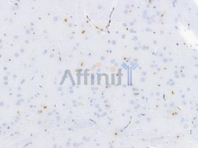 Cyclin D1 Recombinant Rabbit mAb - BF4042 at 1/100 staining Rat brain tissue by IHC-P.