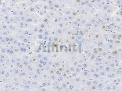 Cyclin D1 Recombinant Rabbit mAb - BF4042 at 1/100 staining Rat liver tissue by IHC-P.