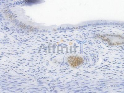Cyclin D1 Recombinant Rabbit mAb - BF4042 at 1/100 staining Rat uterine tissue by IHC-P.
