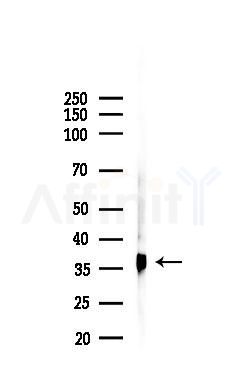 Cyclin D1 Recombinant Rabbit mAb - Western blot analysis of lysates from PC12 cells(UV 30min treatment), using Cyclin D1 Recombinant Rabbit mAb at 1/1000 dilution.