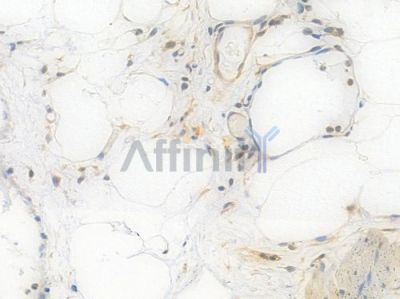 CD86 Recombinant Rabbit mAb - BF4043 at 1/100 staining Human appendiceal tissue by IHC-P.