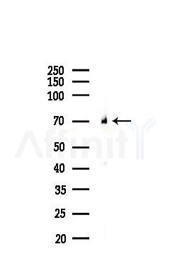 CD86 Recombinant Rabbit mAb - Western blot analysis of lysates from Mouse kidney, using CD86 Recombinant Rabbit mAb at 1/1000 dilution.