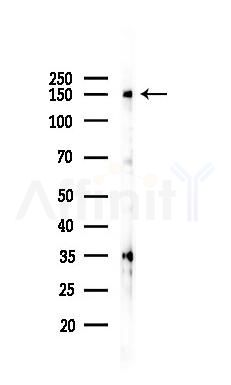EGFR Recombinant Rabbit mAb - Western blot analysis of lysates from HUVEC cells(starvation 24h treatment), using EGFR Recombinant Rabbit mAb at 1/1000 dilution.