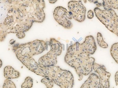 HSP70 Recombinant Rabbit mAb - BF4045 at 1/100 staining Human placental tissue by IHC-P.