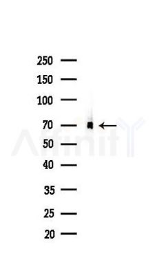 HSP70 Recombinant Rabbit mAb - Western blot analysis of lysates from B16F10-LUC cells(heat-shock 45min treatment), using HSP70 Recombinant Rabbit mAb at 1/1000 dilution.