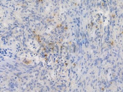 FAK Recombinant Rabbit mAb - BF4047 at 1/100 staining Human spleen tissue by IHC-P.